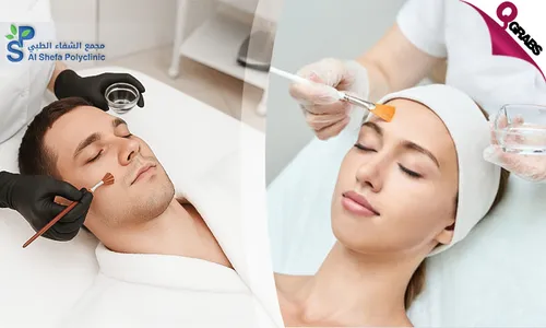 Instant Glow: Chemical Peel for Ladies & Men at Al Shefa Polyclinic!